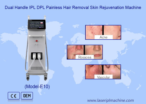 آلة إزالة الشعر المهنية الدائمة IPL OPT epilator تجديد الجلد