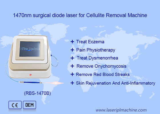 سعر جيد 1470nm 980nm ليزر الديود تحليل الدهون الجراحة جهاز ليزر ذو ذوبان الدهون الانترنت