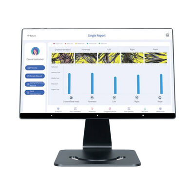 جهاز تحليل فروة الرأس الذكي بتقنية الذكاء الاصطناعي بـ 4 لغات للعناية بفروة الرأس والشعر